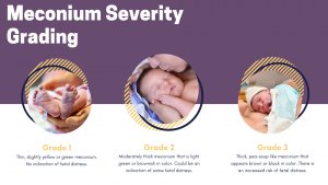 meconium severity grading scale